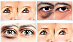 Load image into Gallery viewer, Dark Circles Eye Bags Kit
